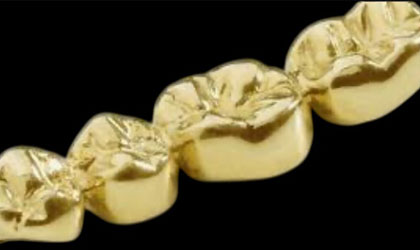 sell-dental-gold-fl
